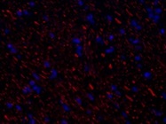 A Very Specific Antibody Against Neurofilament Heavy Protein