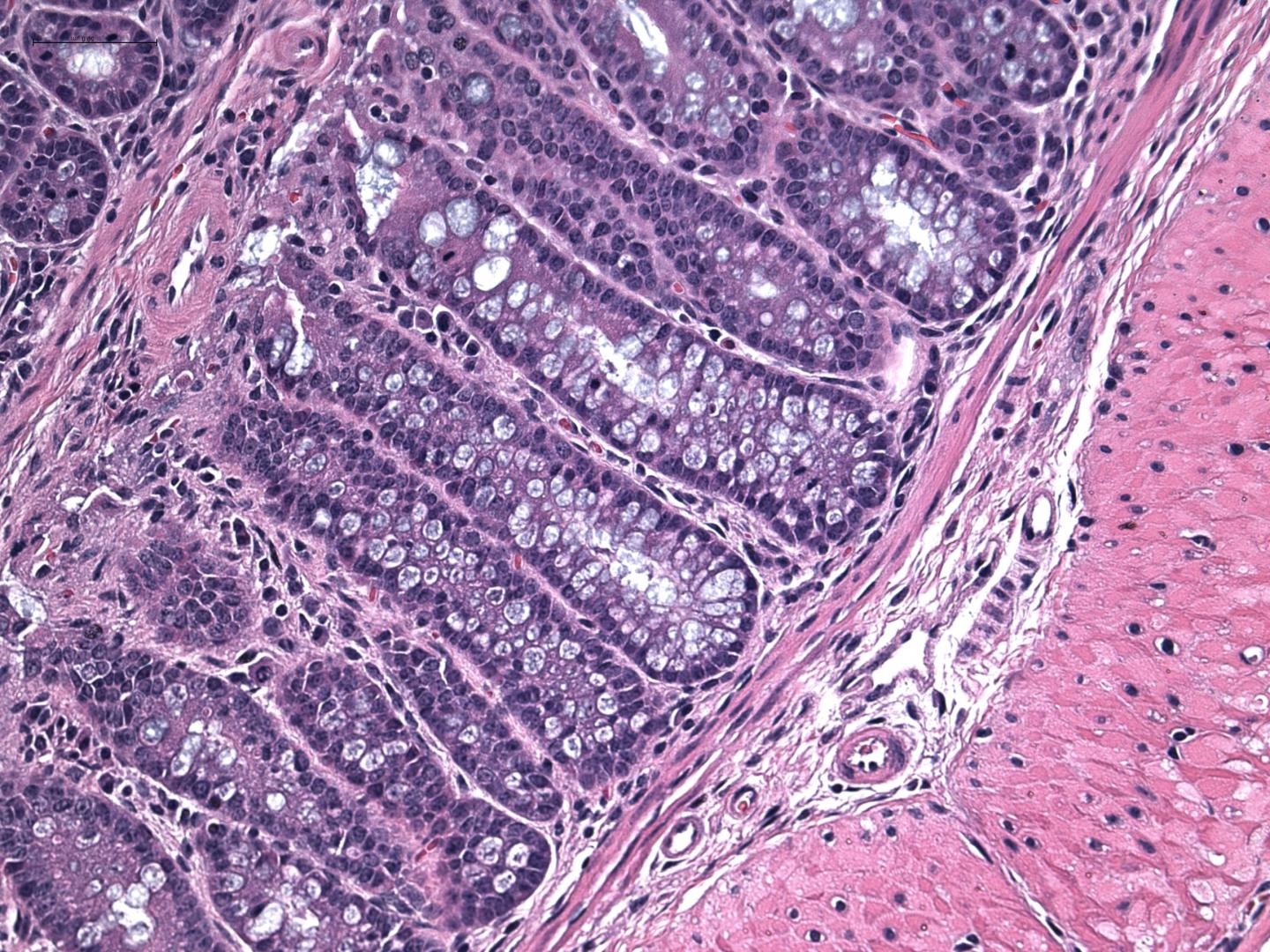 apoptosis