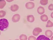 Thawing PBMCs: 10 Steps to Improve Viability and Purity