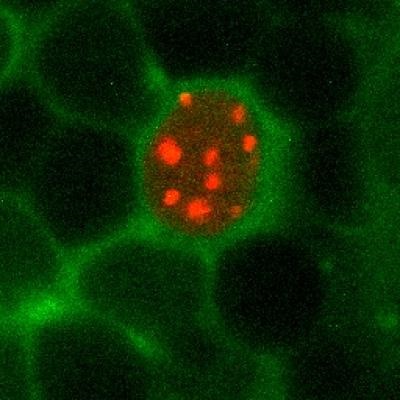 neuronal maintenance