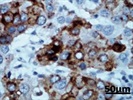 Anti-AFP Antibody (ab169552)