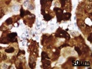 Anti-Arginase-1 Antibody (ab133543)