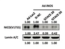 Anti-NICD Antibody (CST4147)