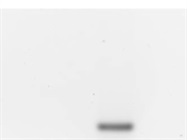 Reverse Transcription with Reduced RNase H Activity