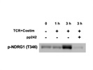Great Antibody to Detect mTORC2 Activity Measured by pNDRG1