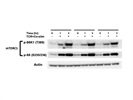 Great Antibody to Measure mTORC1 Signaling through S6K1 Activity