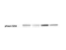 Okay Antibody to Detect p-Foxo1 Activity as a Readout of mTORC2 Signaling