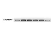 Great Antibody to Detect pMTOR Activity for Western Blotting
