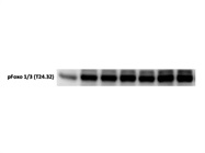 Good Antibody to Detect p-Foxo1/3 Activity