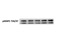 Great Antibody to Detect mTORC1 Activity with 4E-BP1 Readout