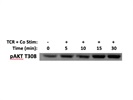 Great Antibody to Detect PI3K Signaling Readout through pAKT