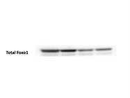 Great Antibody to Detect Total Foxo1 Protein Level for Immunoblotting