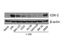 LY 294002 Blocks LPA-Mediated COX-2 Expression