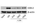 FR 180204 Blocks LPA-Induced COX-2 Expression