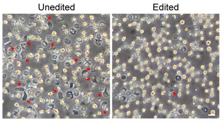 blood stem cells