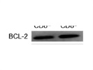 Great Antibody to Detect Bcl-2 Protein Expression in Lysates