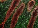 Great EpCAM Antibody for Acetone-Fixed Frozen Tissue Sections