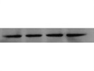 Phospho-NF-kB p65 Antibody Great for Western Blotting from CST