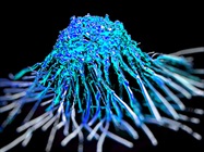 Cancer Immunotherapy Research Receives Boost from Single-Cell Genomics