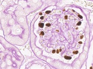 Awesome Kip2 Antibody from Boster Bio