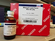 Excellent Qiagen Kit for Isolating RNA from Fatty Tissues