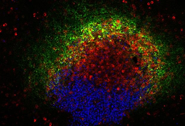 B cells