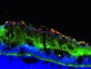Very Good MYH10 Antibody from Thermo Fisher