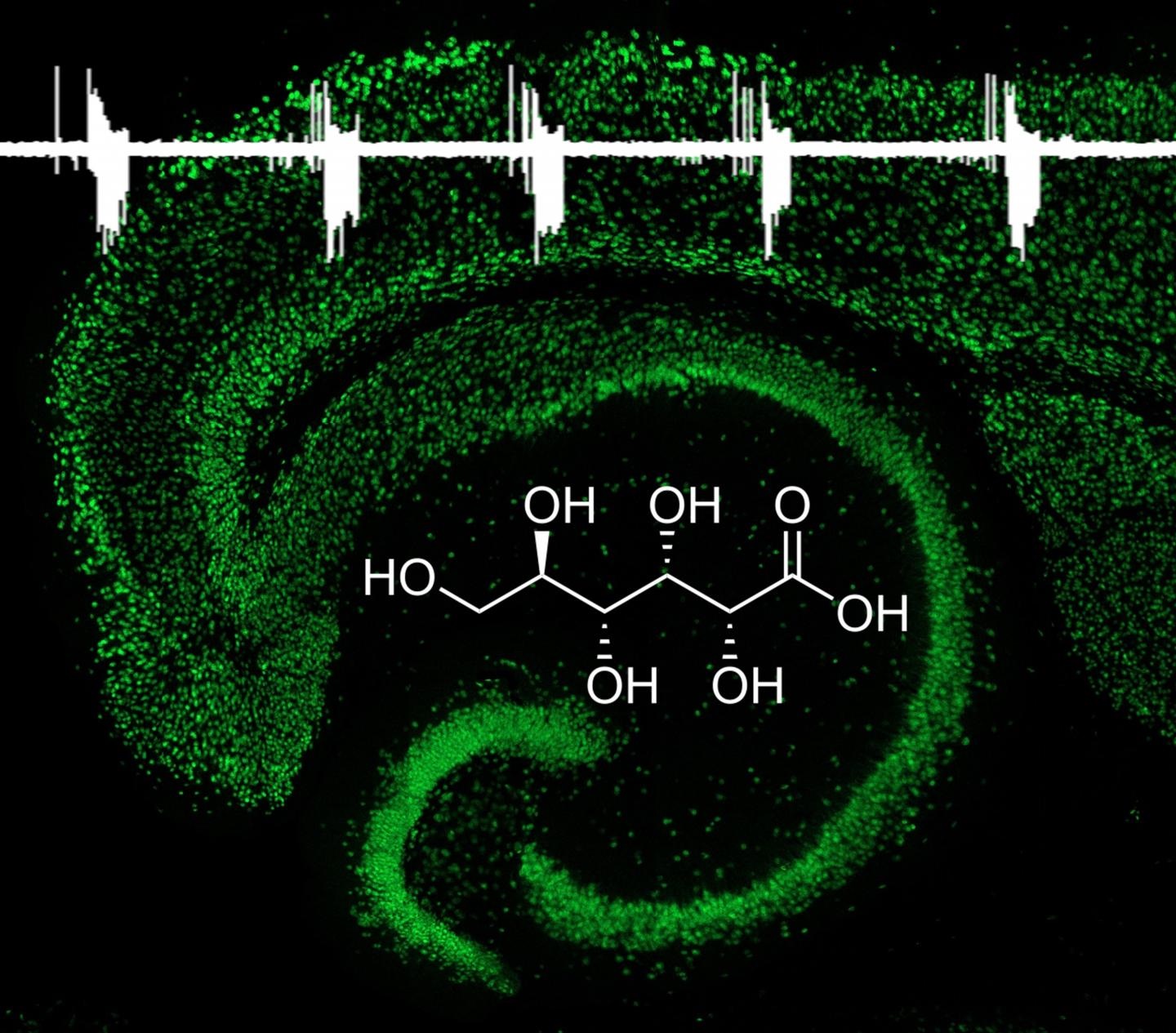 neonatal hippocampus