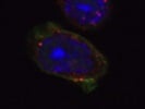 Excellent GLUT1 Antibody for IF but Extremely Unspecific for Western Blot