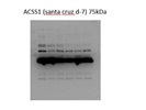 Reliable Antibody for Looking at ACSS1 from Santa Cruz