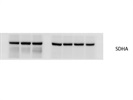 Bright Antibody from CST for Looking at SDHA in Western Blot