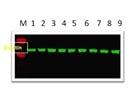 ß-Actin: House Keeping Gene for Western Blot