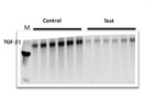 Santa Cruz TGFß1 Antibody Works Well