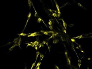 Anit-Vimentin on Breast Cancer Cells (Sigma)
