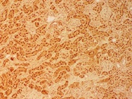 Abcam MAT2A Antibody Works Well on Kidney