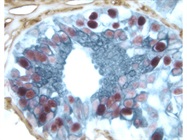 VECTASTAIN® Elite ABC-Peroxidase Kit