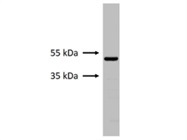 GFAP Expression in Primary Mouse Microglia