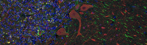 immunostaining