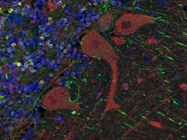 How to Achieve Good IHC Results