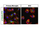 Visualization of Microtubules Network in Microglia