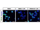A Good Antibody for the Detection of RELMa