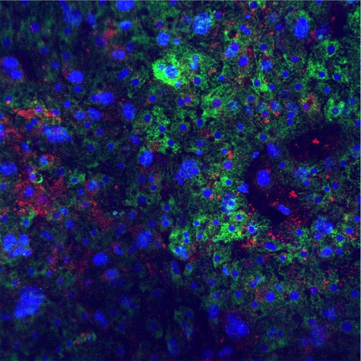 Studying Hepatitis B and Delta Infection in Cell Culture | Biocompare ...