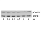 Saxagliptin Inhibits CaMKII Phosphorylation