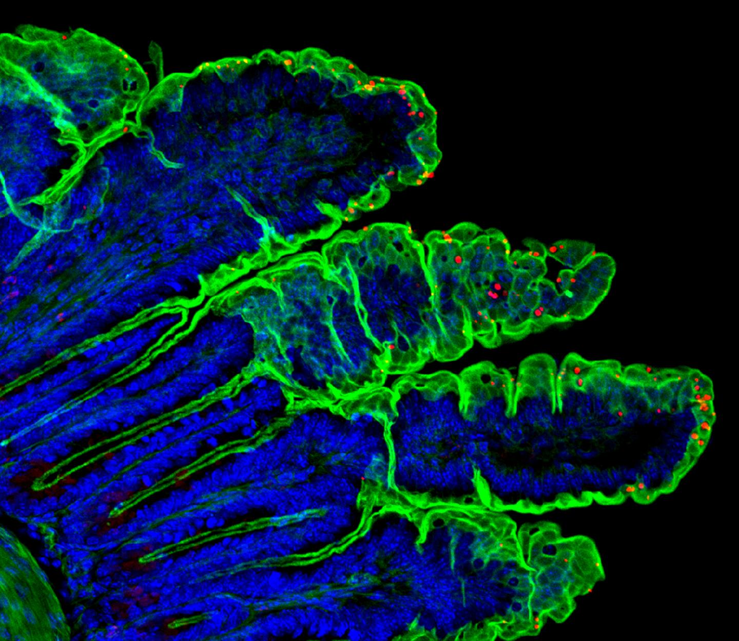 Model of Cryptosporidium 