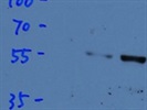 A Good Antibody for PPARg WB from Santa Cruz