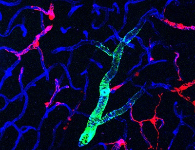 pericytes