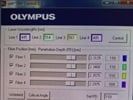 Easy Visualization for TIRF and Widefield Microscopy - Olympus