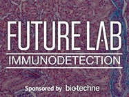 Improved Antigen Detection in Immunohistochemistry