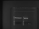 PCR Master Mix for Superior Performance for a Broad Range of Amplicons (NEB)