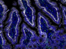 Abcam Beta III Tubulin Antibody Works Well for Immunofluorescence